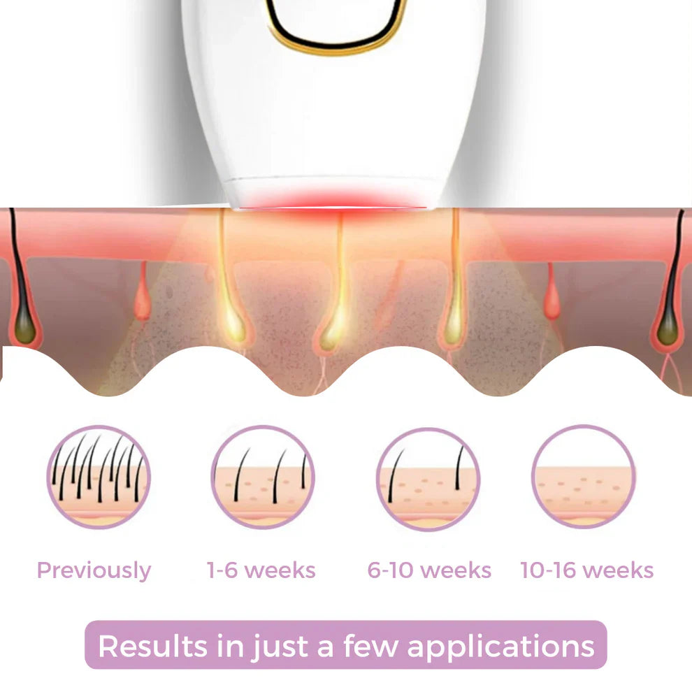 Ruvorae - IPL Hair Remover