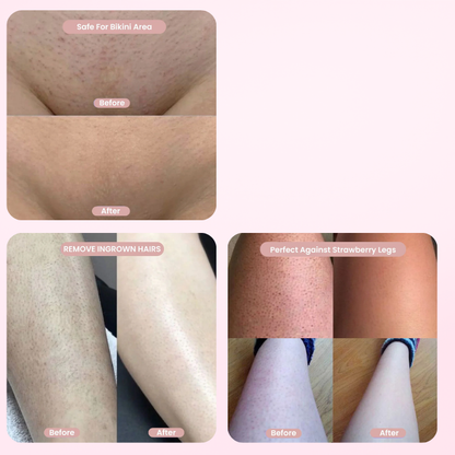 Ruvorae – 2-in-1 Women’s Body Shaver